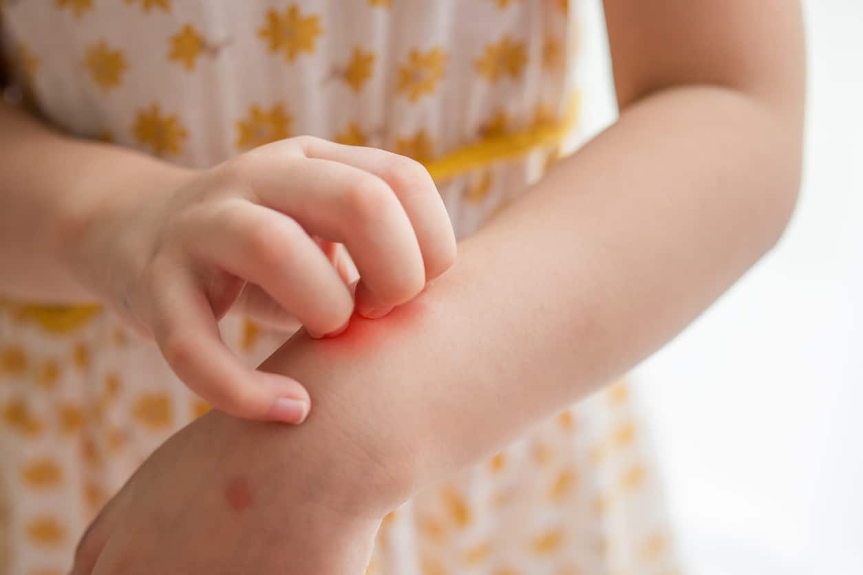 Young girl scratching her arm.
