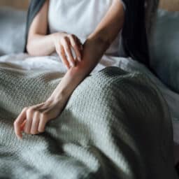 Woman with allergic reaction scratches arm